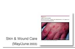 Skin & Wound Care